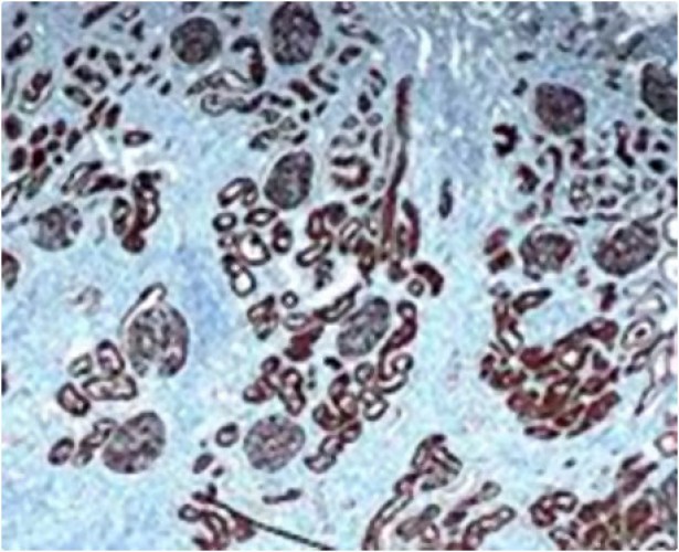 Immunohistochimie.jpg