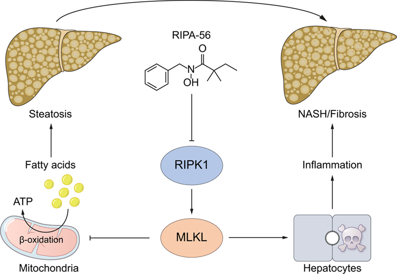 2020 J Hepatol - Majdi (fig).jpg