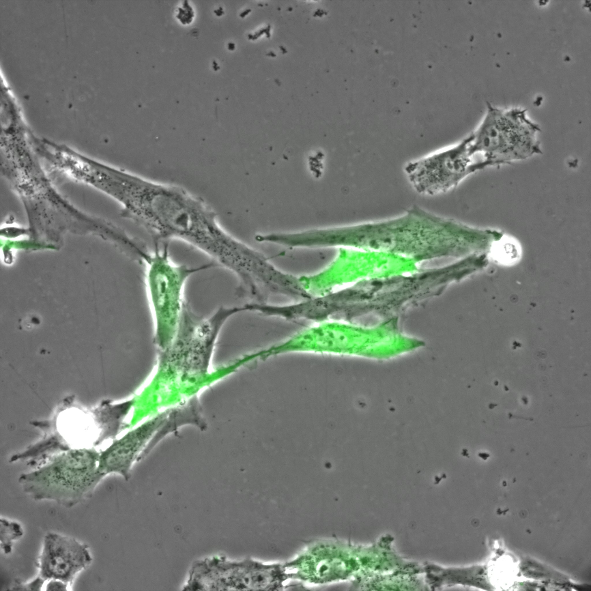 Contrast Phase+Fluo.jpg